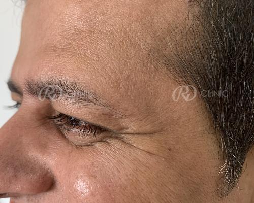 Before and after result 12